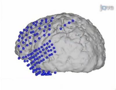 Cortical Mapping