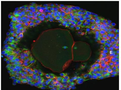 Hopes growing after fertility treatment breakthrough