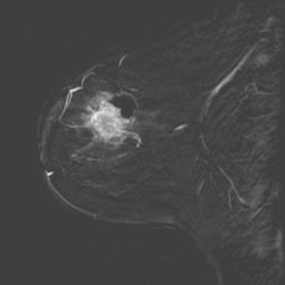 Microwave imaging can see how well treatment is progressing | Science Codex