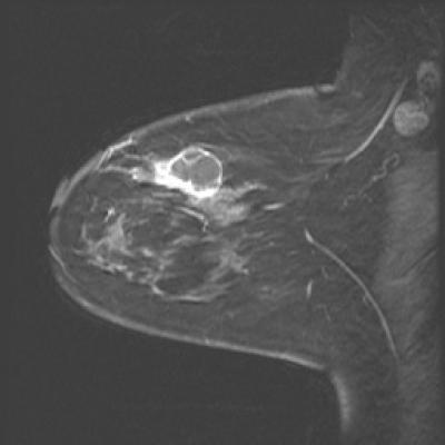 Microwave imaging can see how well treatment is progressing | Science Codex