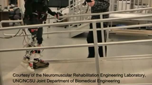 Researchers Study Impact Of Power Prosthetic Failures On Amputees ...