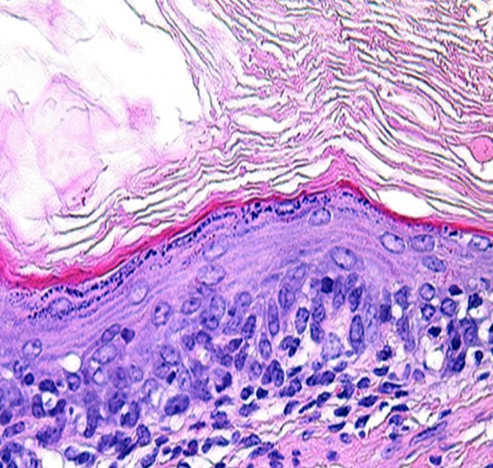 First step: From human cells to tissue-engineered esophagus | Science Codex