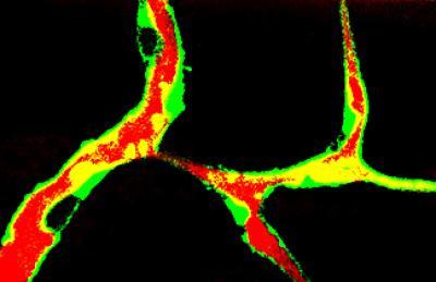 Cholesterol sets off chaotic blood vessel growth | Science Codex